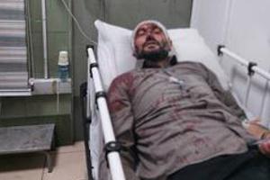  مجروح شدن یکی از شهرداران تهران با ضربات قمه  - Gooya News