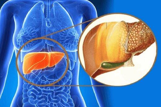 غذاهای مضر برای کبد چرب را بشناسید