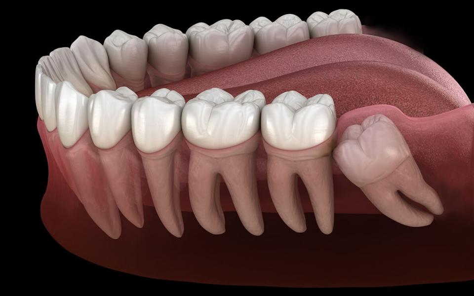 ماجرای واردات یونیت‌های دندانپزشکی با وجود تولید داخل چه بود؟