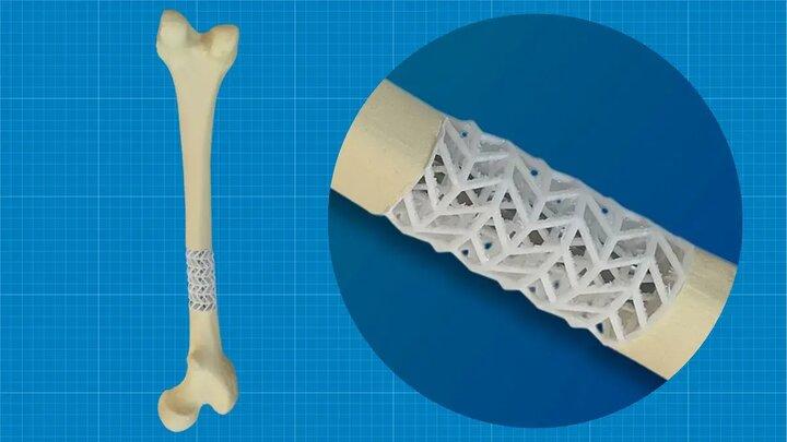 توسعه داربست زیستی برای ترمیم استخوان‌های شکسته